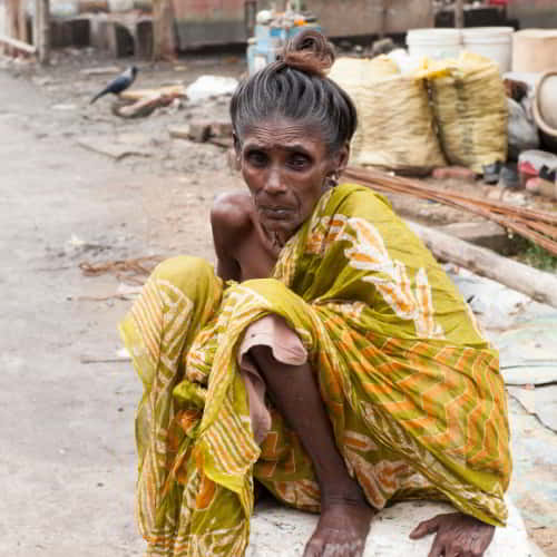 Sick and malnourished woman, suffering the effects of poverty