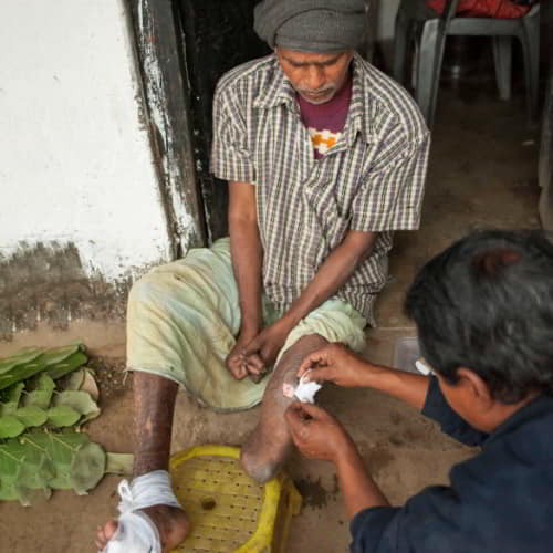 GFA World medical camps bringing health and help to leprosy patients